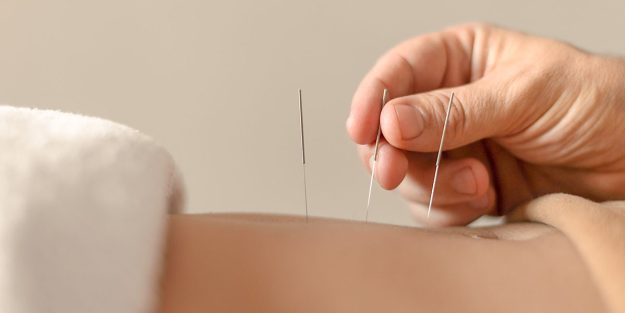 Acupuntura como Terapia Complementar após um AVC Acupuntura como Terapia Complementar após um AVC